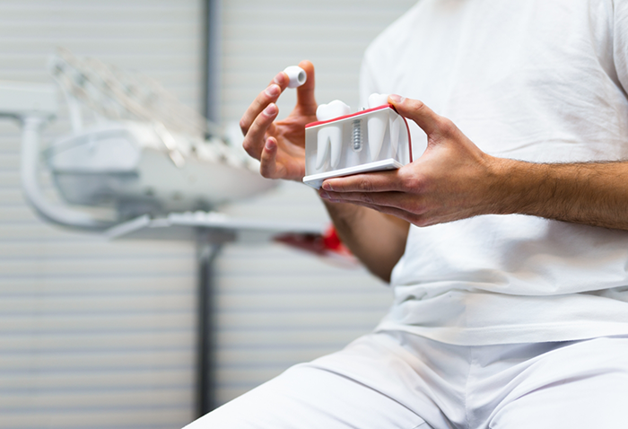 Dentist holding a model of a dental implant