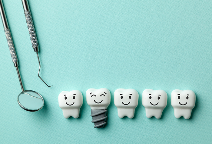Illustration of a smiling dental implant in between several smiling teeth
