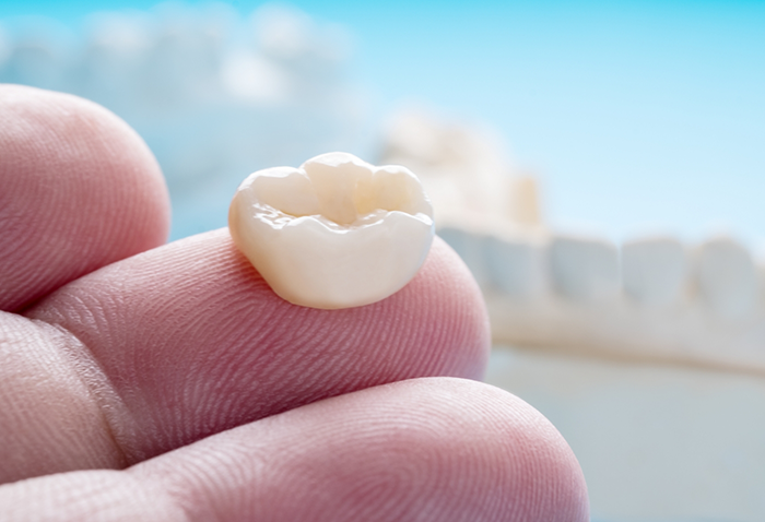 Close up of a dental crown resting on a person's finger