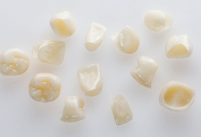 Several porcelain dental crowns