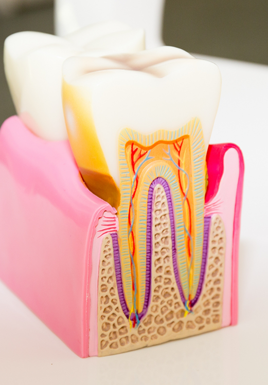 Model of a tooth showing the root canals inside of it