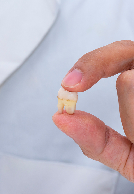 Dentist holding an extracted tooth